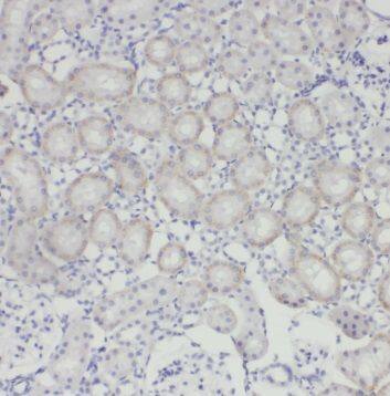 Immunohistochemistry TRUB1 Antibody - BSA Free