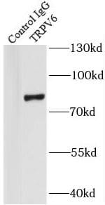 Immunoprecipitation TRPV6 Antibody - BSA Free