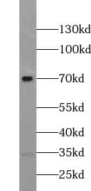 Western Blot TRPV6 Antibody - BSA Free