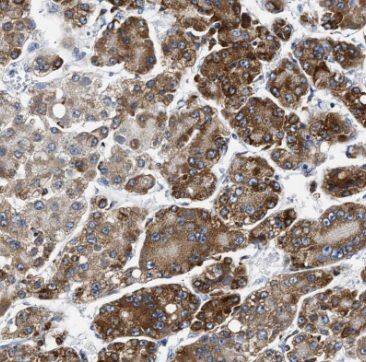 Immunohistochemistry TRPT1 Antibody - BSA Free