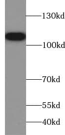 Western Blot TROAP Antibody - BSA Free