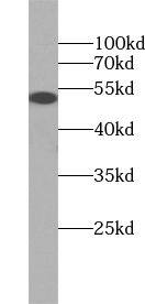 Western Blot: TRMT61B Antibody - BSA Free [NBP3-45723] - HepG2 cells were subjected to SDS PAGE followed by western blot with (TRMT61B Antibody) at dilution of 1:600