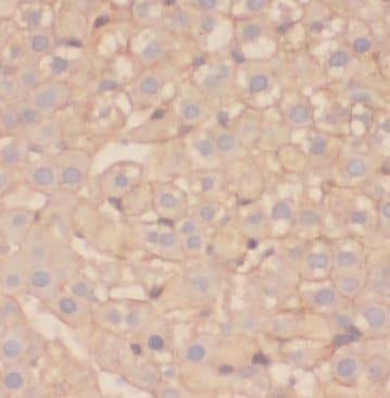 Immunohistochemistry TRM11 Antibody - BSA Free