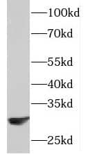 Western Blot: PAAF1 Antibody - BSA Free [NBP3-45733] - Mouse brain tissue were subjected to SDS PAGE followed by western blot with (PAAF1 antibody) at dilution of 1:2000