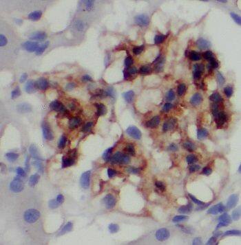 Immunohistochemistry PAAF1 Antibody - BSA Free