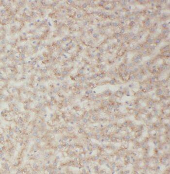 Immunohistochemistry TRIM14 Antibody - BSA Free