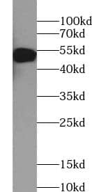Western Blot: Trim11 Antibody - BSA Free [NBP3-45735] - HEK-293 cells were subjected to SDS PAGE followed by western blot with (Trim11 antibody) at dilution of 1:100