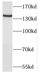 Western Blot: TRAPPC9 Antibody - BSA Free [NBP3-45739] - Mouse brain tissue were subjected to SDS PAGE followed by western blot with (TRAPPC9 antibody) at dilution of 1:800