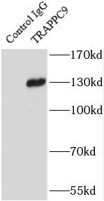 Immunoprecipitation: TRAPPC9 Antibody - BSA Free [NBP3-45739] - IP Result of anti-TRAPPC9 (IP:, 4ug; Detection: 1:500) with mouse brain tissue lysate 3600ug.