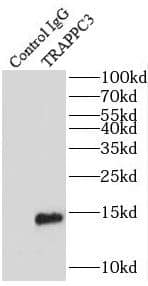 Immunoprecipitation: TRAPPC3 Antibody - BSA Free [NBP3-45740] - IP Result of anti-TRAPPC3 (IP:, 3ug; Detection: 1:800) with mouse liver tissue lysate 4000ug.