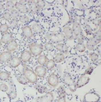 Immunohistochemistry TRAPPC2L Antibody - BSA Free
