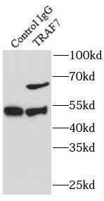 Immunoprecipitation: TRAF7 Antibody - BSA Free [NBP3-45744] - IP Result of anti-TRAF7 (IP:, 3ug; Detection: 1:300) with mouse liver tissue lysate 3000ug.