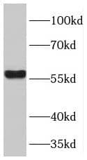 Western Blot: TPTE2 Antibody - BSA Free [NBP3-45747] - L02 cells were subjected to SDS PAGE followed by western blot with (TPTE2 Antibody) at dilution of 1:300