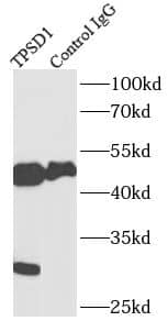 Immunoprecipitation TPSD1 Antibody - BSA Free