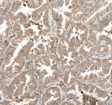 Immunohistochemistry TPSD1 Antibody - BSA Free