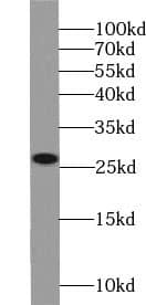 Western Blot TPSD1 Antibody - BSA Free