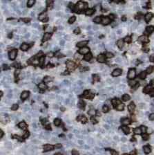 Immunohistochemistry STX11 Antibody - BSA Free