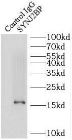 Immunoprecipitation SYNJ2BP/ARIP2 Antibody - BSA Free