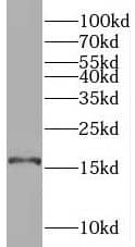 Western Blot SYNJ2BP/ARIP2 Antibody - BSA Free