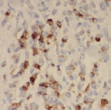 Immunohistochemistry SYNJ2BP/ARIP2 Antibody - BSA Free