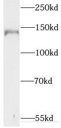 Western Blot: Synaptojanin 1 Antibody - BSA Free [NBP3-45765] - Mouse brain tissue were subjected to SDS PAGE followed by western blot with ( Synaptojanin 1 Antibody) at dilution of 1:4000