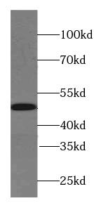 Western Blot: Synaptotagmin 4 Antibody - BSA Free [NBP3-45766] - SH-SY5Y cells were subjected to SDS PAGE followed by western blot with (Synaptotagmin 4 antibody) at dilution of 1:500