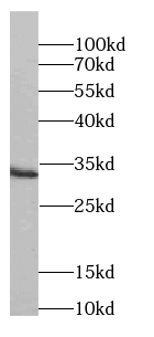 Western Blot: Synaptogyrin 4 Antibody - BSA Free [NBP3-45771] - Human brain tissue were subjected to SDS PAGE followed by western blot with (Synaptogyrin 4 antibody) at dilution of 1:300