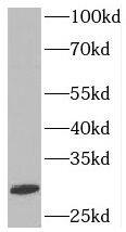 Western Blot: SYF2 Antibody - BSA Free [NBP3-45773] - HEK-293 cells were subjected to SDS PAGE followed by western blot with (SYF2 antibody) at dilution of 1:600