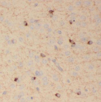 Immunohistochemistry SV2B Antibody - BSA Free