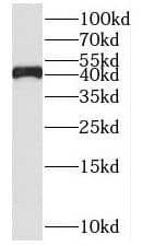 Western Blot: SDS3 Antibody - BSA Free [NBP3-45779] - Raji cells were subjected to SDS PAGE followed by western blot with (SDS3 Antibody) at dilution of 1:600
