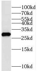 Western Blot: Amisyn Antibody - BSA Free [NBP3-45780] - Mouse brain tissue were subjected to SDS PAGE followed by western blot with (Amisyn antibody) at dilution of 1:500