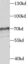Western Blot: Syntaxin Binding Protein 4 Antibody - BSA Free [NBP3-45782] - Human heart tissue were subjected to SDS PAGE followed by western blot with (Syntaxin Binding Protein 4 antibody) at dilution of 1:1000