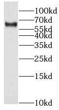 Western Blot Steroid sulfatase Antibody - BSA Free