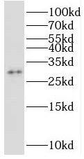 Western Blot STOML3 Antibody - BSA Free
