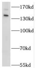 Western Blot STK36 Antibody - BSA Free