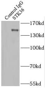 Immunoprecipitation STK36 Antibody - BSA Free