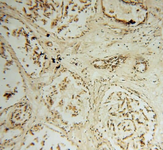 Immunohistochemistry STK36 Antibody - BSA Free