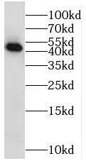 Western Blot: STK32A Antibody - BSA Free [NBP3-45793] - HeLa cells were subjected to SDS PAGE followed by western blot with (STK32A antibody) at dilution of 1:800