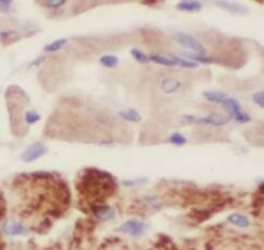 Immunohistochemistry ABRA Antibody - BSA Free