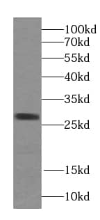 Western Blot: STARD3NL Antibody - BSA Free [NBP3-45802] - HEK-293 cells were subjected to SDS PAGE followed by western blot with (STARD3NL antibody) at dilution of 1:1000