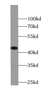 Western Blot: ST8SIA3 Antibody - BSA Free [NBP3-45806] - Mouse liver tissue were subjected to SDS PAGE followed by western blot with (ST8SIA3 antibody) at dilution of 1:800