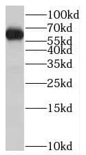 Western Blot ST7L Antibody - BSA Free