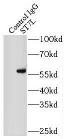 Immunoprecipitation ST7L Antibody - BSA Free