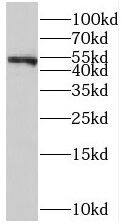 Western Blot: ST3GAL6 Antibody - BSA Free [NBP3-45808] - Human placenta tissue were subjected to SDS PAGE followed by western blot with (ST3GAL6 antibody) at dilution of 1:200