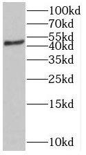 Western Blot: ST3GAL5 Antibody - BSA Free [NBP3-45809] - HEK-293 cells were subjected to SDS PAGE followed by western blot with (ST3GAL5 antibody) at dilution of 1:500
