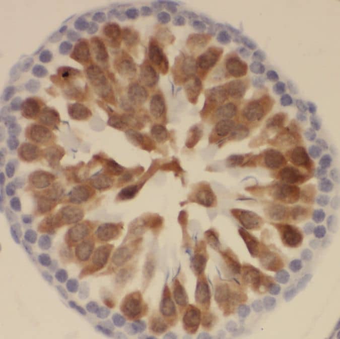 Immunohistochemistry: SSX4 Antibody - BSA Free [NBP3-45811] - Immunohistochemistry of paraffin-embedded human testis using (SSX4 antibody) at dilution of 1:50