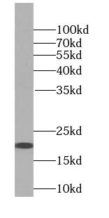 Western Blot Signal sequence receptor delta Antibody - BSA Free