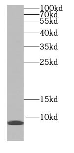Western Blot SS18L2 Antibody - BSA Free