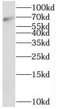 Western Blot: SRP68 Antibody - BSA Free [NBP3-45818] - Human kidney tissue were subjected to SDS PAGE followed by western blot with (SRP68 antibody) at dilution of 1:400