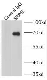 Immunoprecipitation: SRP68 Antibody - BSA Free [NBP3-45818] - IP Result of anti-SRP68 (IP:, 4ug; Detection: 1:400) with mouse kidney tissue lysate 4000ug.